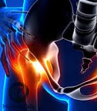 Slider image (8) MexStemCells Clinic for Chronic Degenerative Wellness